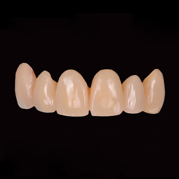 Prótesis dentales